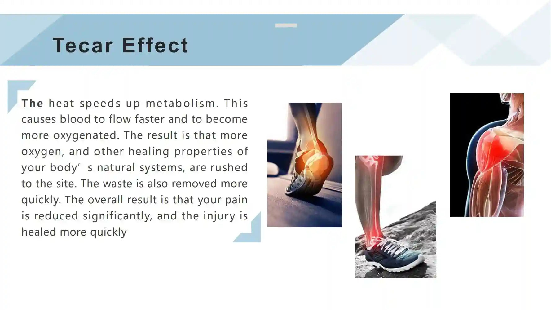 Tecar Therapy Pain Relief Machine CET RET EMS for Muscle Recovery Back Massage Instrument Tidesmit