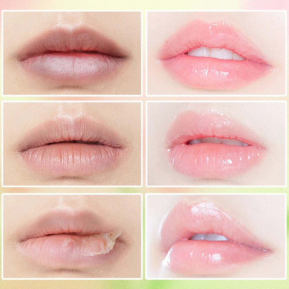 Exfoliating Lip Scrub: Moisturizing Fruit Sugar Treatment - 50g Lip Care Tidesmit