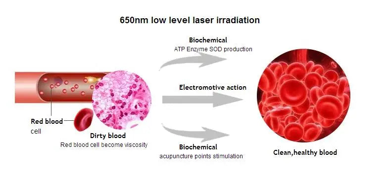 Laser Therapy Wrist Watch for Blood Sugar and Pressure Management Relaxation Treatment Tidesmit