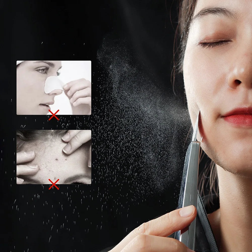 Ultrasonic Facial Skin Scrubber | Professional Deep Cleaning Spatula Scrubs Treatments Tidesmit