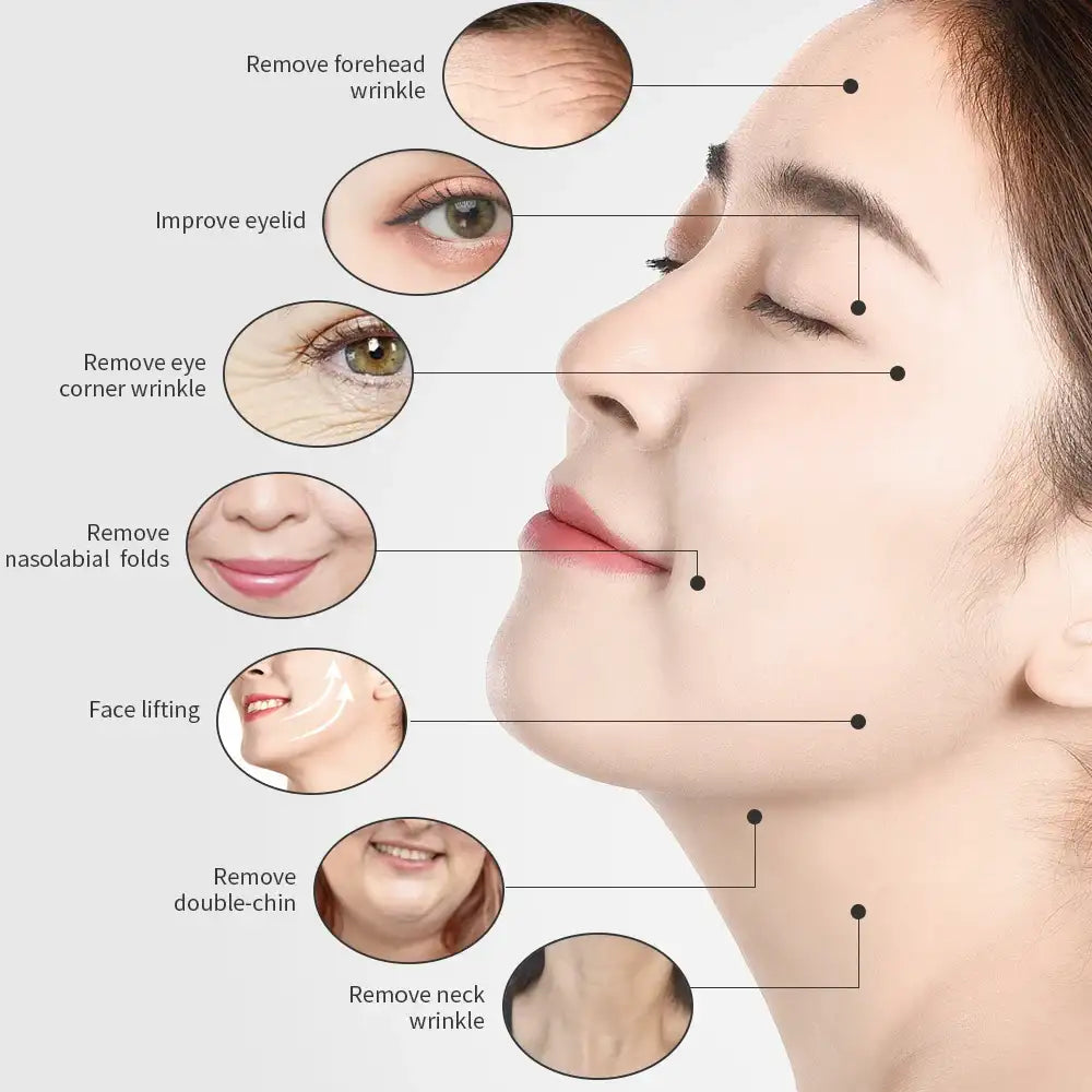 Diagram showing a side-profile of a woman's face with callouts illustrating skin lifting and wrinkle reduction areas.