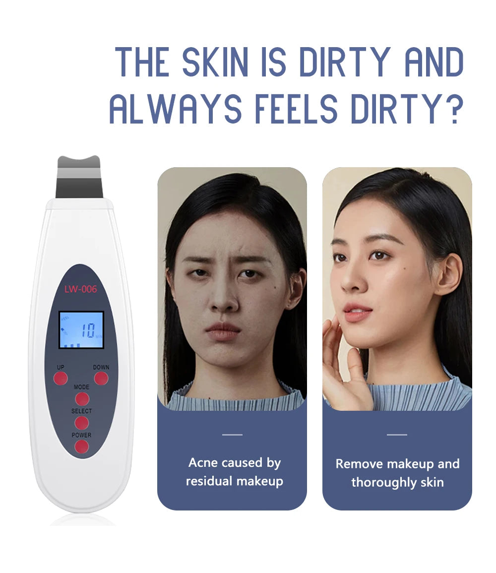 Ultrasonic Skin Scrubber - Professional Deep Pore Cleansing & Lifting Tool Scrubs Treatments Tidesmit