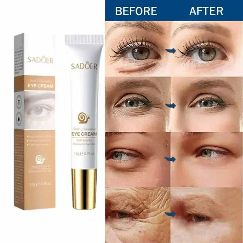 Instant Anti Aging Eye Cream for Dark Circles and Puffiness | Tidesmit Relaxation Treatment Tidesmit