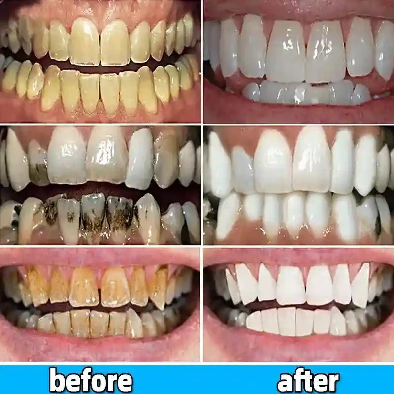 Tidesmit teeth whitening toothpaste for dental calculus removal and breath freshening daily oral care