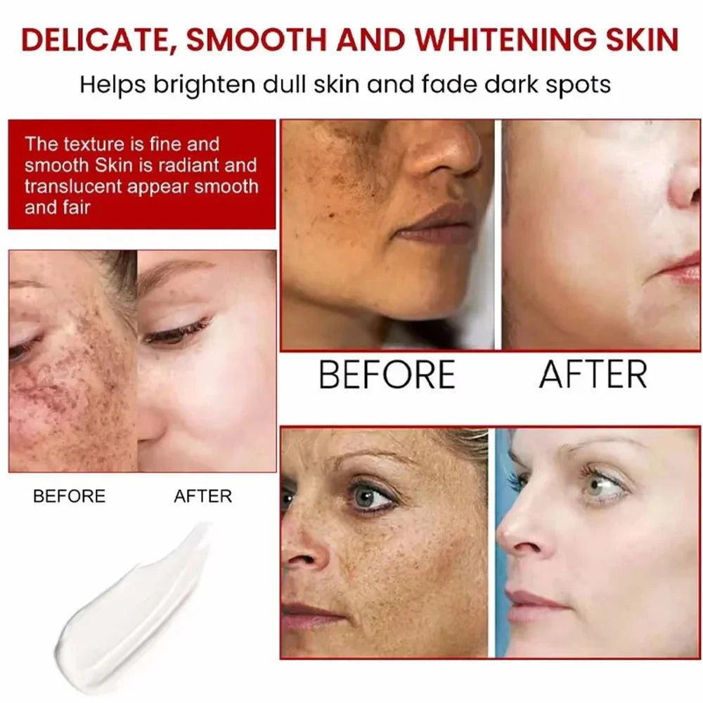 Before and after results of a skin-brightening cream showing reduced dark spots and smoother skin texture.