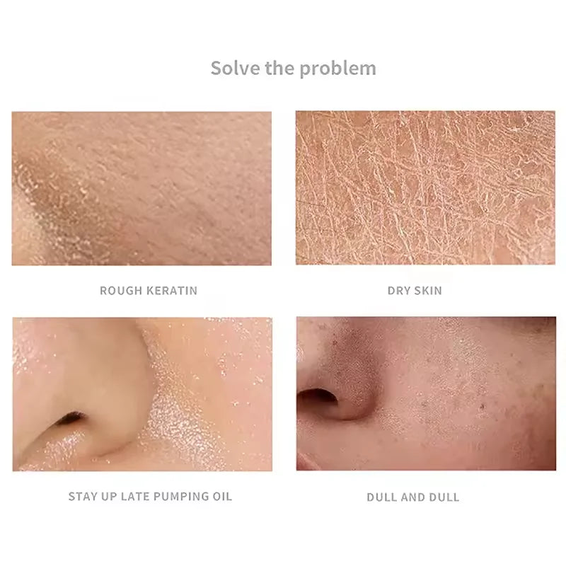 Four close-up photos showing skin conditions: rough keratin, dry skin, oily skin from lack of sleep, and dull