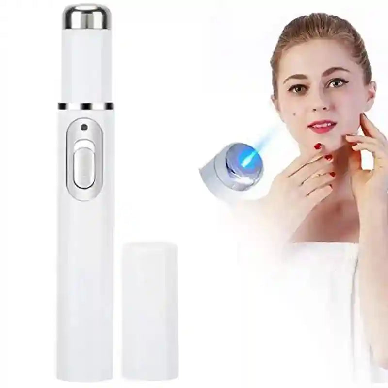 Eye Massage Instrument - Sonic Vibration Device for Dark Circles (White) Eye Massage Instrument WHITE Tidesmit