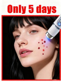 A device with a blue light tip is held against a woman's cheek, which has several small red marks.