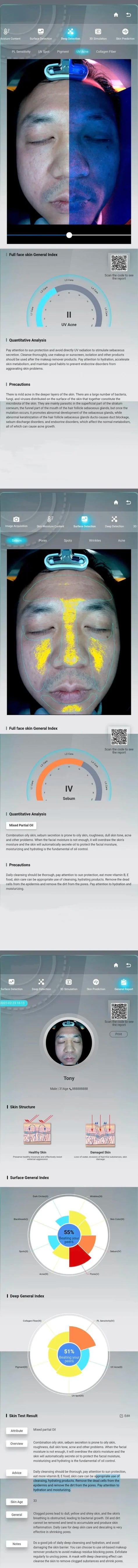 Portable 3D skin analysis machine displaying facial moisture, oil, and texture results on a digital mirror interface.