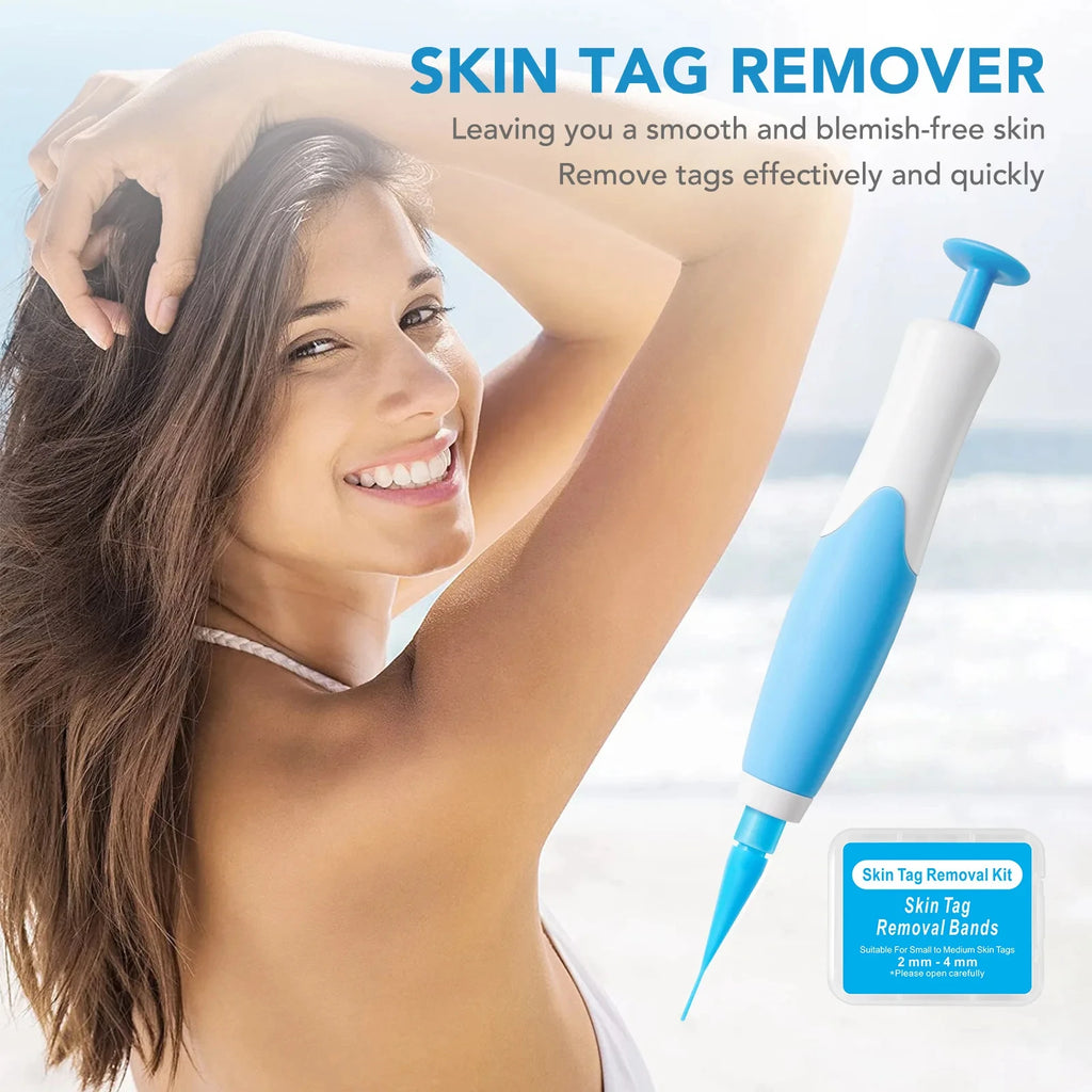 Blue and white skin tag removal pen kit for painless home mole and wart treatment for face and body skin care.