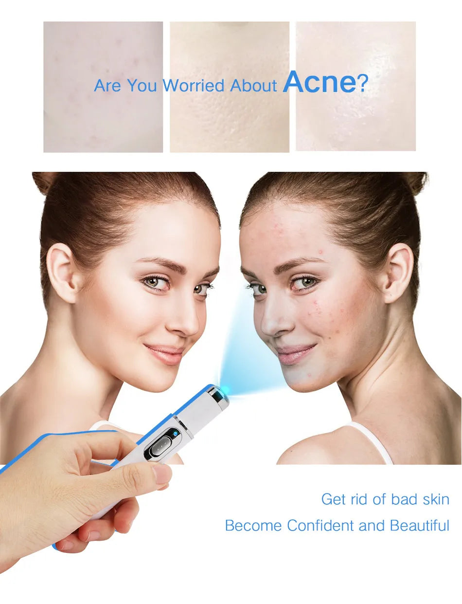Blue Light Therapy Acne Pen for Skin Repair and Wrinkle Removal Permanent Makeup Machines Tidesmit