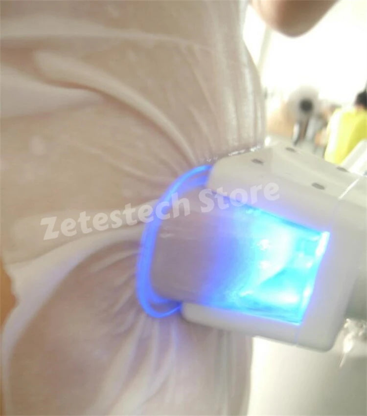 Cryolipolysis Antifreeze Membrane Pads - Skin Protection for Coolsculpting Fascia Gun Tidesmit