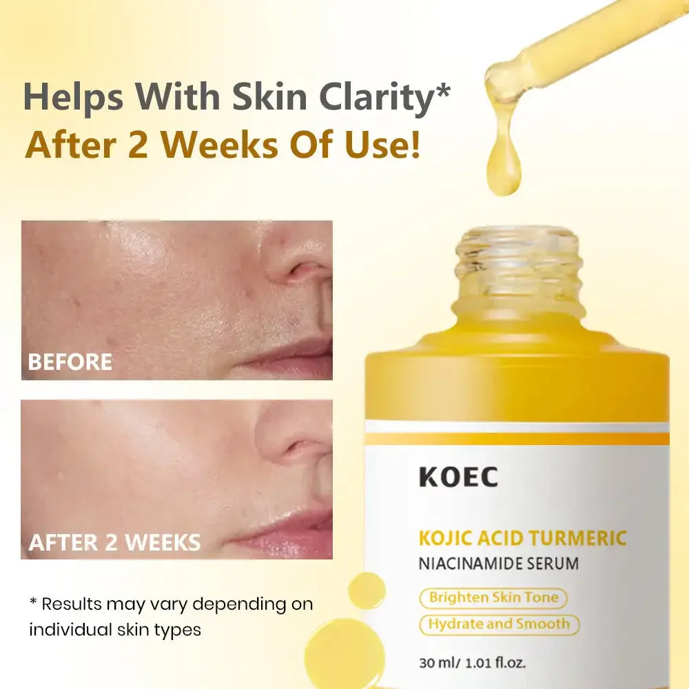 30ml KOEC Kojic Acid Turmeric Niacinamide Serum Hydrating Smoothing Brightening Improve Skin Clarity Anti-Aging Natural Formula