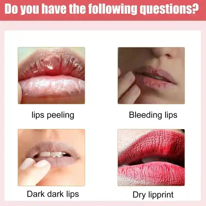 Dark Lip Lightening Serum - Exfoliating Lip Repair Balm by Tidesmit Lip Care Tidesmit
