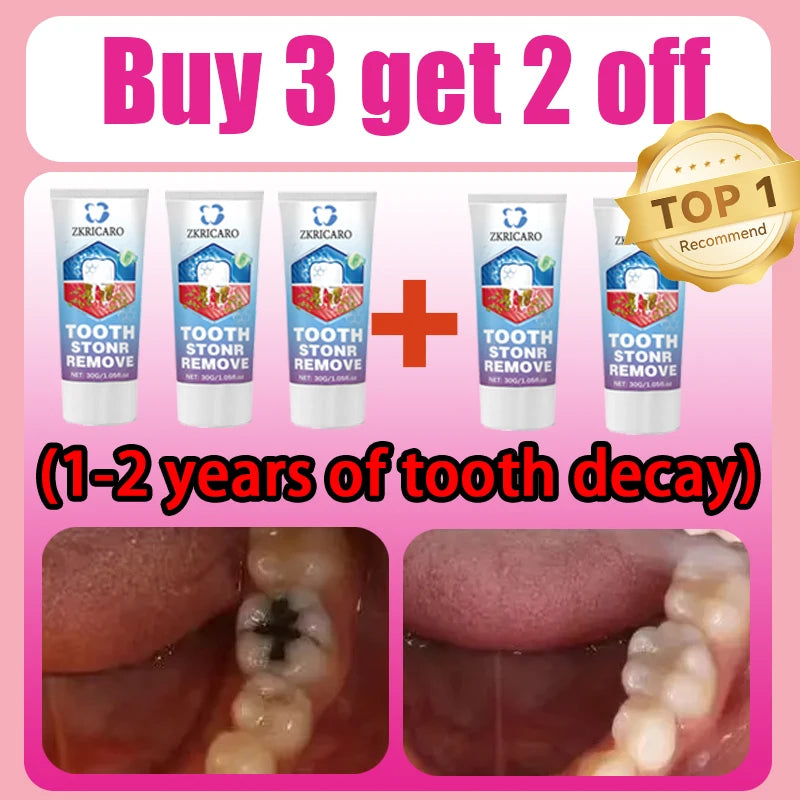 Teeth Whitening Scrub Paste | Deep Cleaning Dental Treatment Scrubs Treatments Buy 3 Get 2 Free Tidesmit