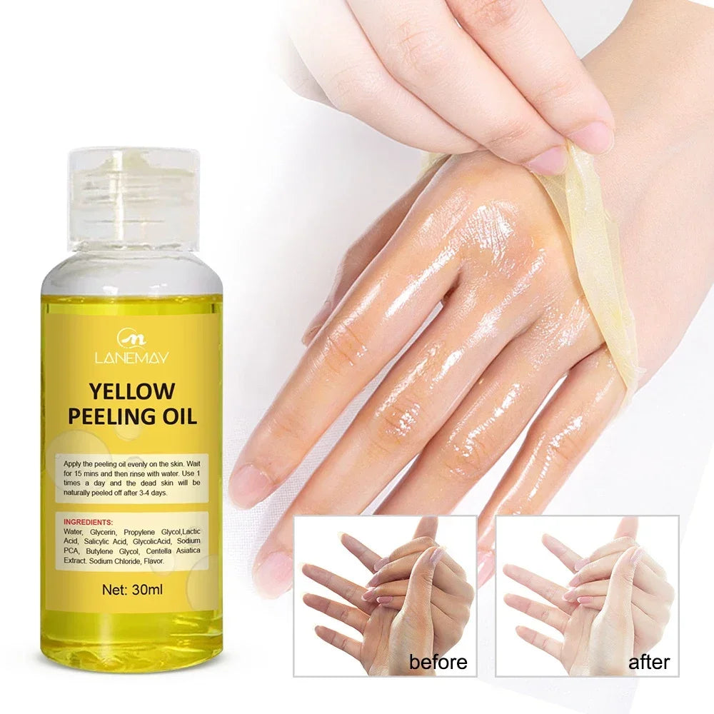 Yellow Peeling Oil for Body Exfoliation - Professional Brightening Serum Scrubs Treatments Tidesmit