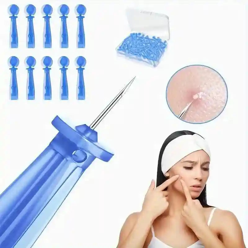 Disposable blue plastic acne needles with a sharp metal tip, shown in a storage box and in use on facial blemishes.