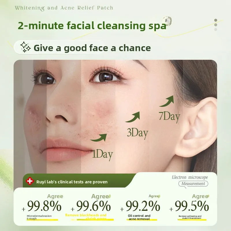 Aloe Vera Exfoliating Gel 300g - Professional Deep Pore Cleansing Face Scrub Scrubs Treatments Tidesmit