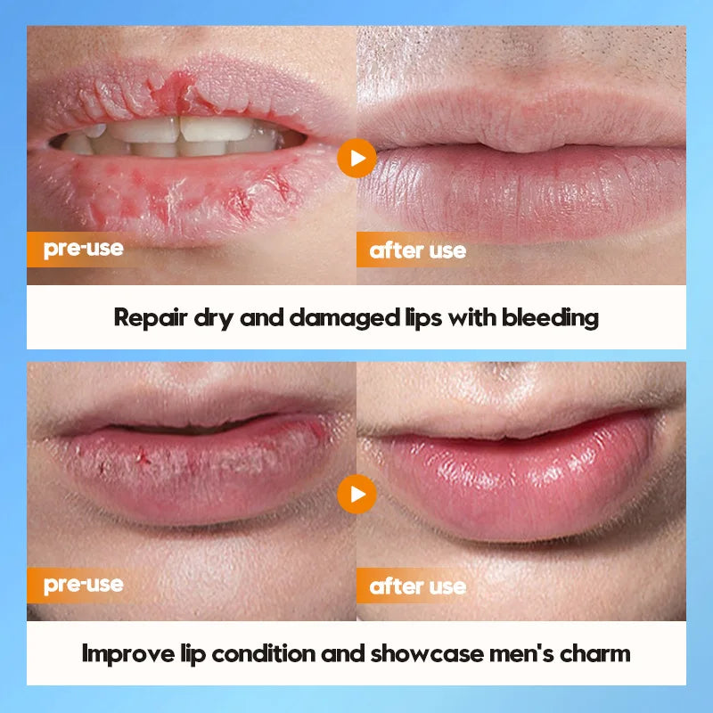 Mens Lip Balm - Deep Hydration & Repair Treatment | Tidesmit Lip Care Tidesmit