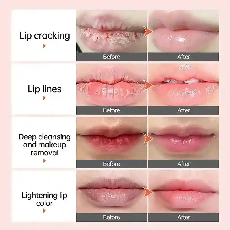 Dark Lip Lightening Balm: Moisturizing Treatment by Tidesmit Lip Care Tidesmit
