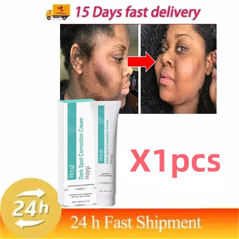 Dark Spot Corrector Cream for Pigmentation & PMU Aftercare | Tidesmit Permanent Makeup Machines 1pc Tidesmit