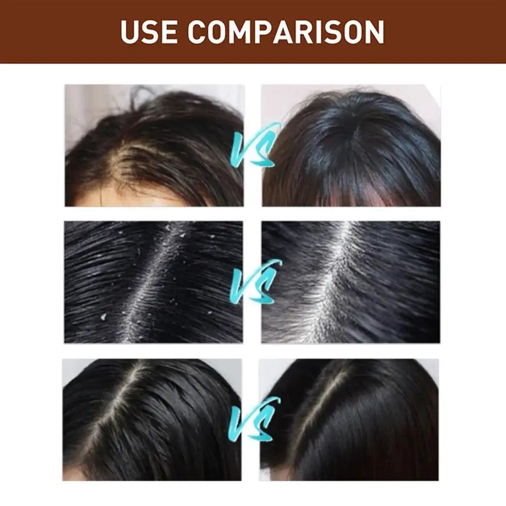 Polygonum Hair Darkening Shampoo Soap Repair Gray White Hair Color To Black Shampoo Soap Hair Nourishing Handmade Shampoo Soap