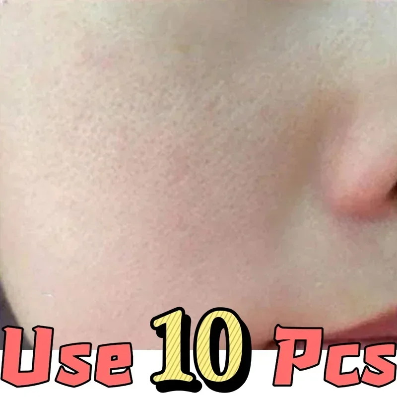 Close-up of human cheek and nose skin for use with skincare pore strips, provided in a 10-piece set.