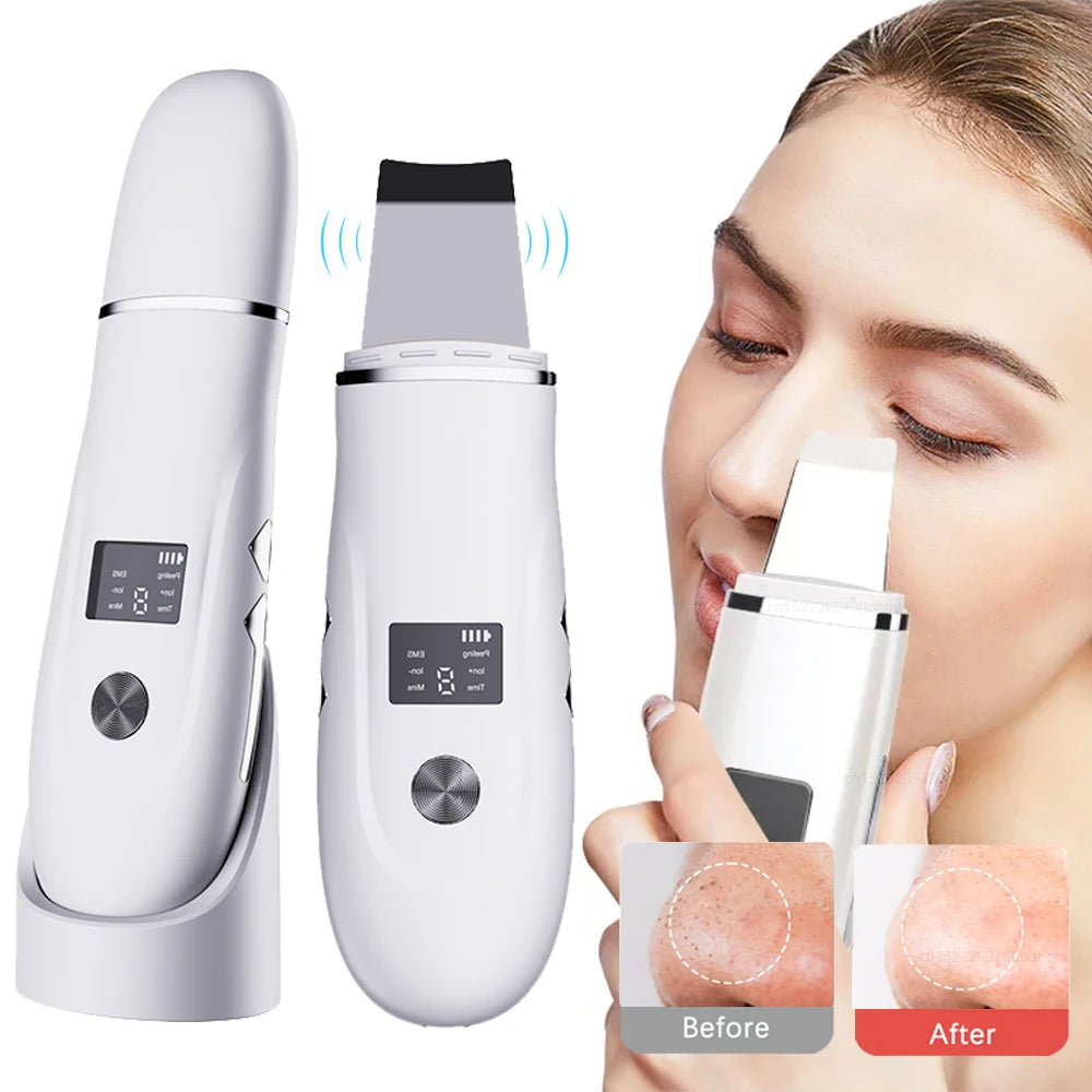 Ultrasonic Face Scrubber - Deep Pore Cleaning & Blackhead Removal Device Scrubs Treatments Tidesmit