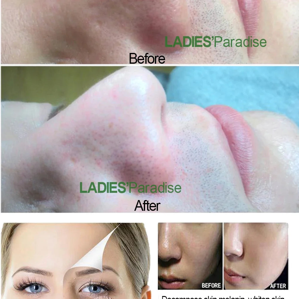 Ultrasonic Facial Skin Scrubber | Deep Pore Exfoliator & Spa Tool Scrubs Treatments Tidesmit