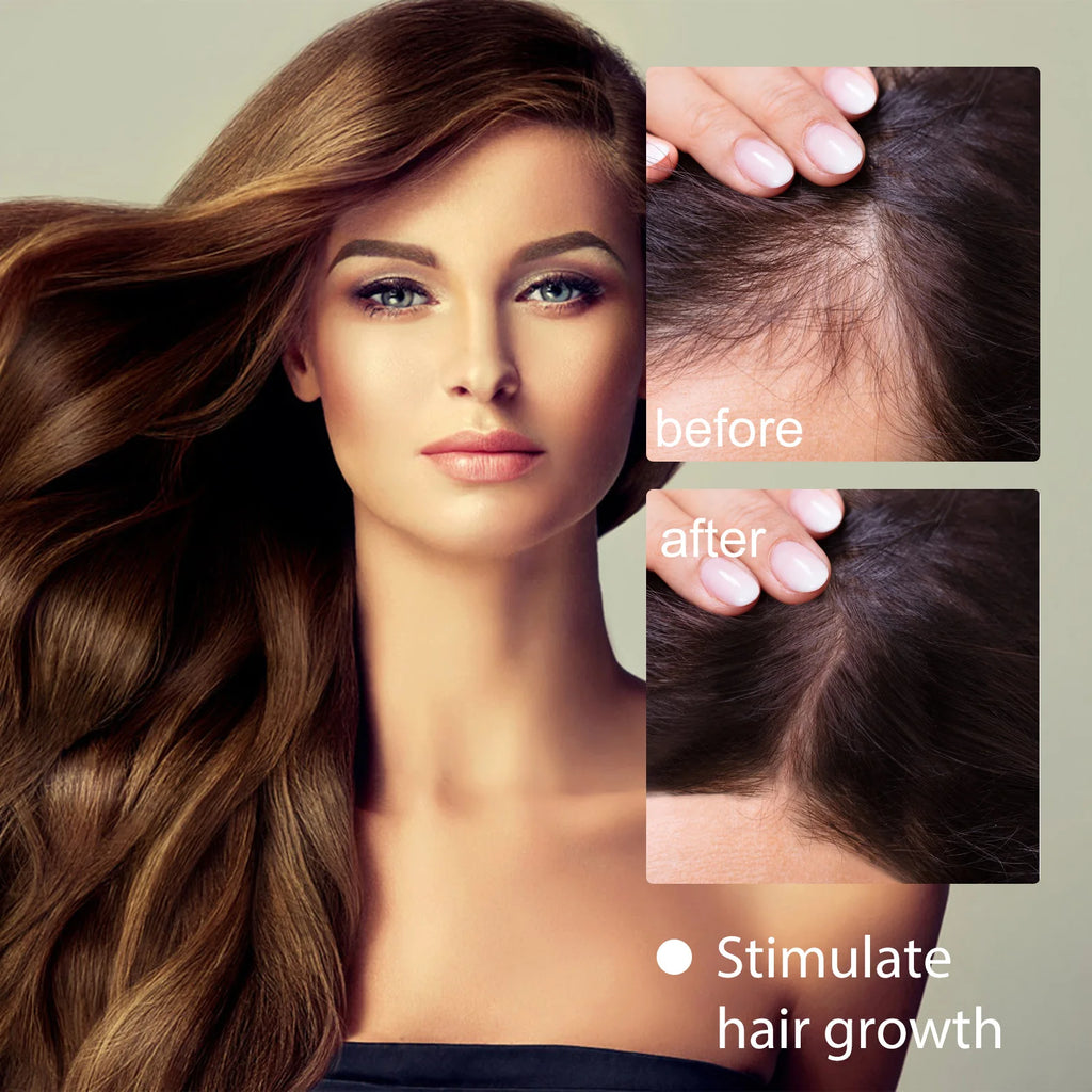 Rice Water Shampoo Soap Solid Hair Growth Shampoo Bar Hair Regrow Shampoo Bar Drop Shipping