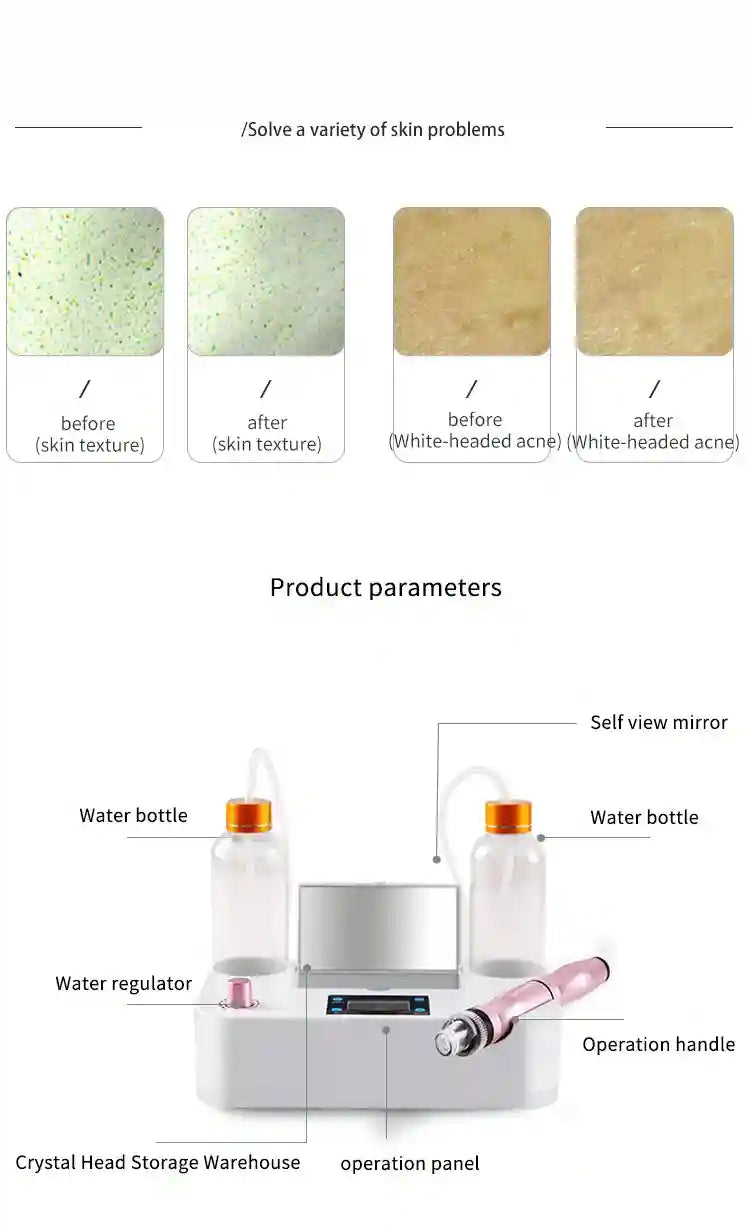 Hydro Facial Machine for Deep Pore Cleansing and Blackhead Extraction Eye Massage Instrument Tidesmit