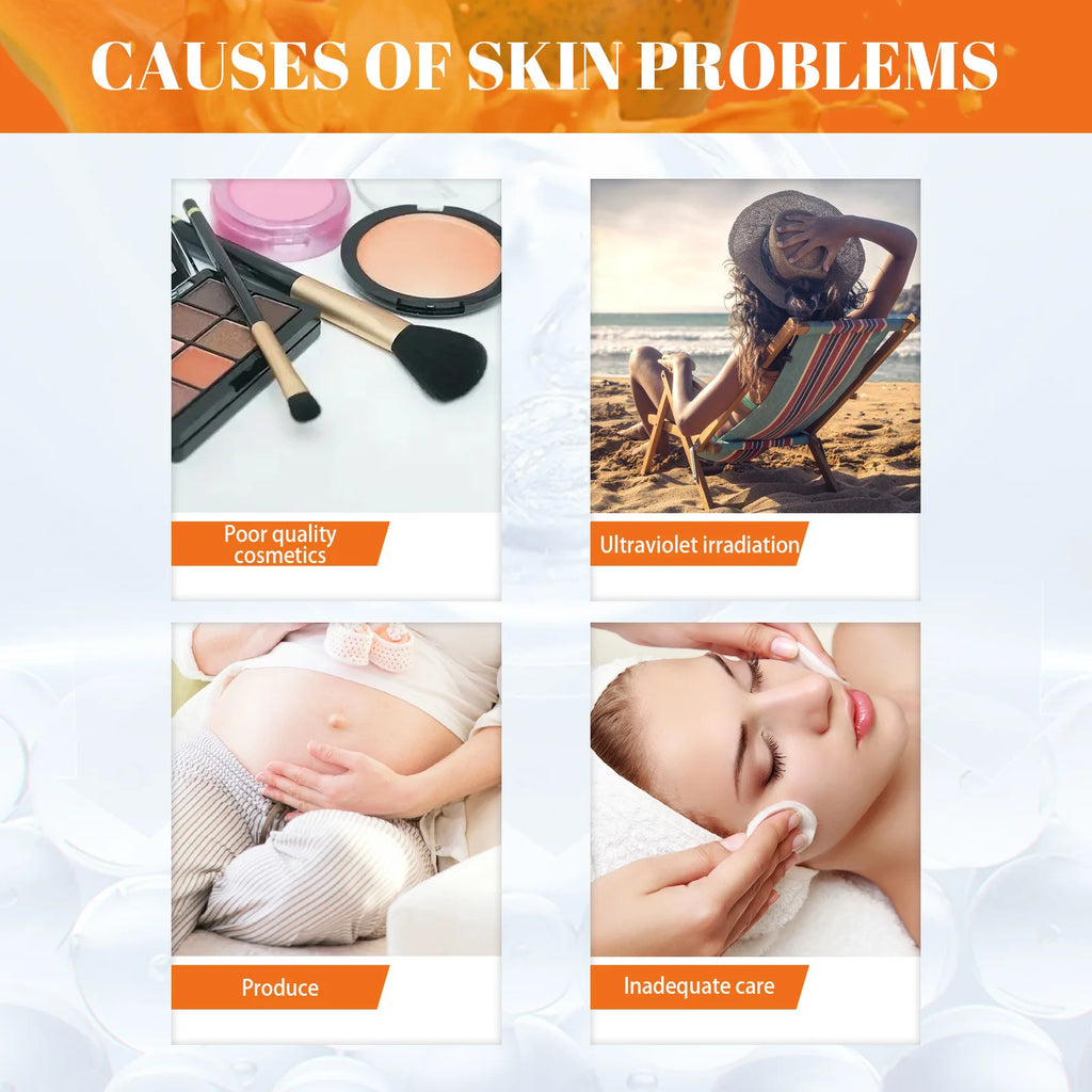 Tidesmit EELHOE papaya whitening freckle cream for dark spot correction and brightening in a 40g jar texture close-up