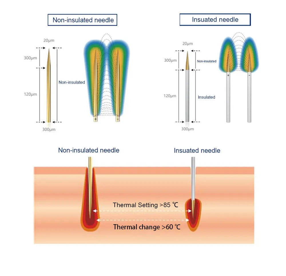 Diagram of insulated vs non-insulated RF microneedles for fractional skin tightening and wrinkle removal device.
