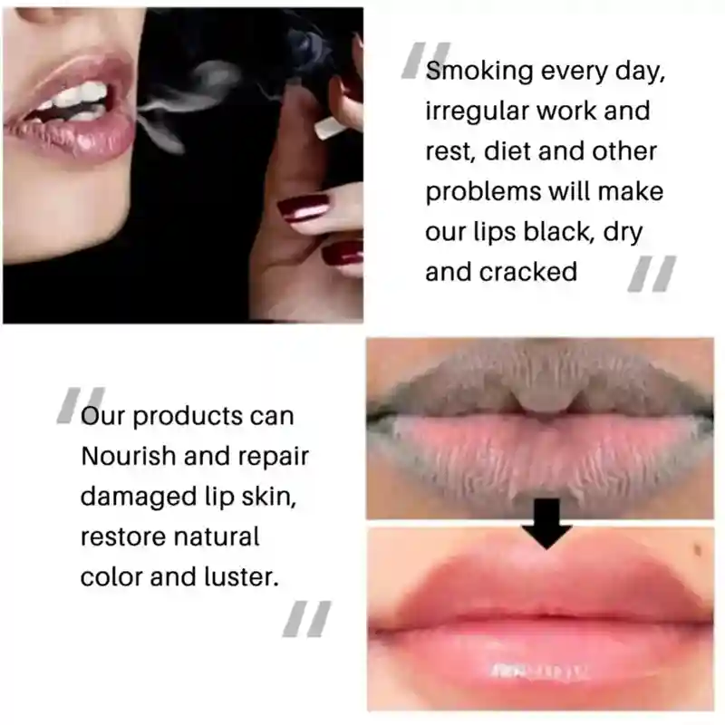 Dark Lip Lightening Balm: Moisturizing Treatment by Tidesmit Lip Care Tidesmit