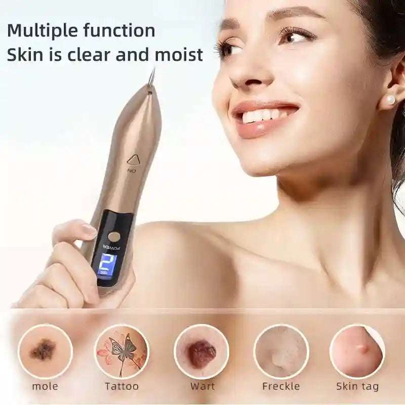 Gold handheld skin spot removal pen with LED display for tattoo, mole, wart, freckle, and skin tag removal at home.