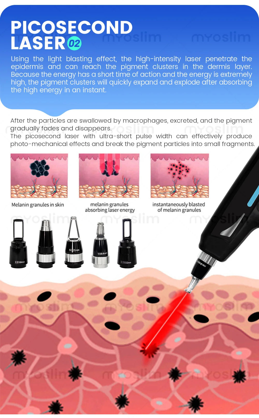 Tidesmit 4-in-1 Ice Platinum laser hair removal machine with 755 808 940 1064nm wavelengths showing side profile view