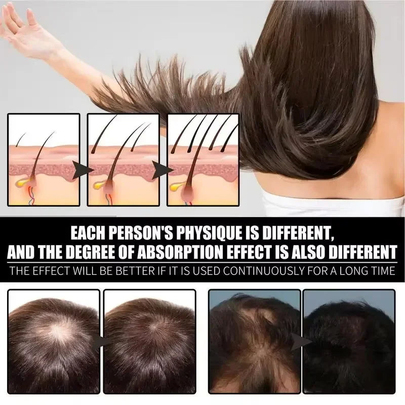 Tidesmit fast hair growth serum capsules for scalp treatment, anti-hair loss, and natural hair regrowth repair.