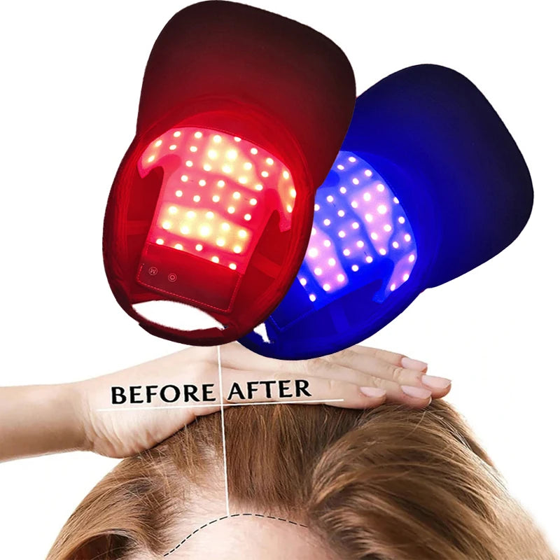 Red Light Therapy For Hair Fast Growth Cap Red&Infrared Light Therapy Device For Hair Loss Treatment With USB Charging Anti-hair