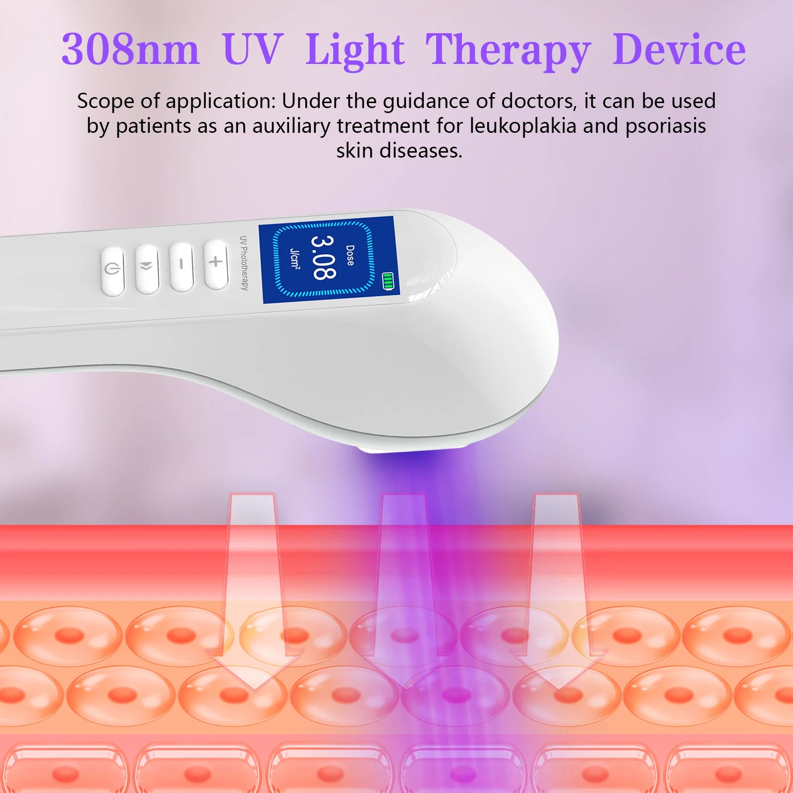 White handheld 308nm UV light therapy device with digital display, used for treating skin conditions like psoriasis.
