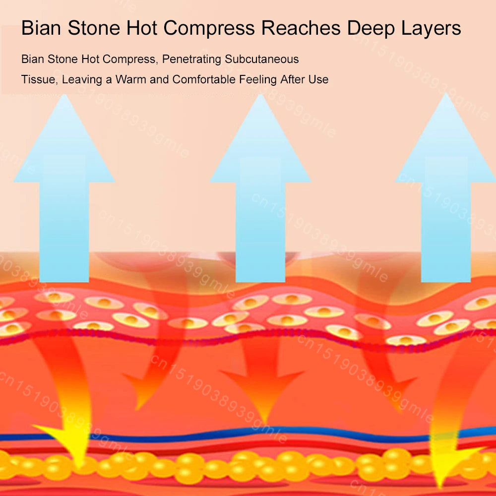 Diagram showing Bian stone hot compress therapy penetrating skin layers with heat-transmitting arrows.