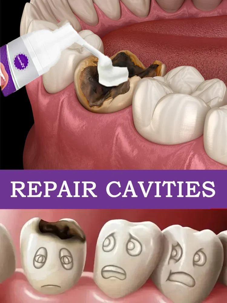 Tidesmit anti-caries teeth whitening treatment for healing cavities and enamel repair