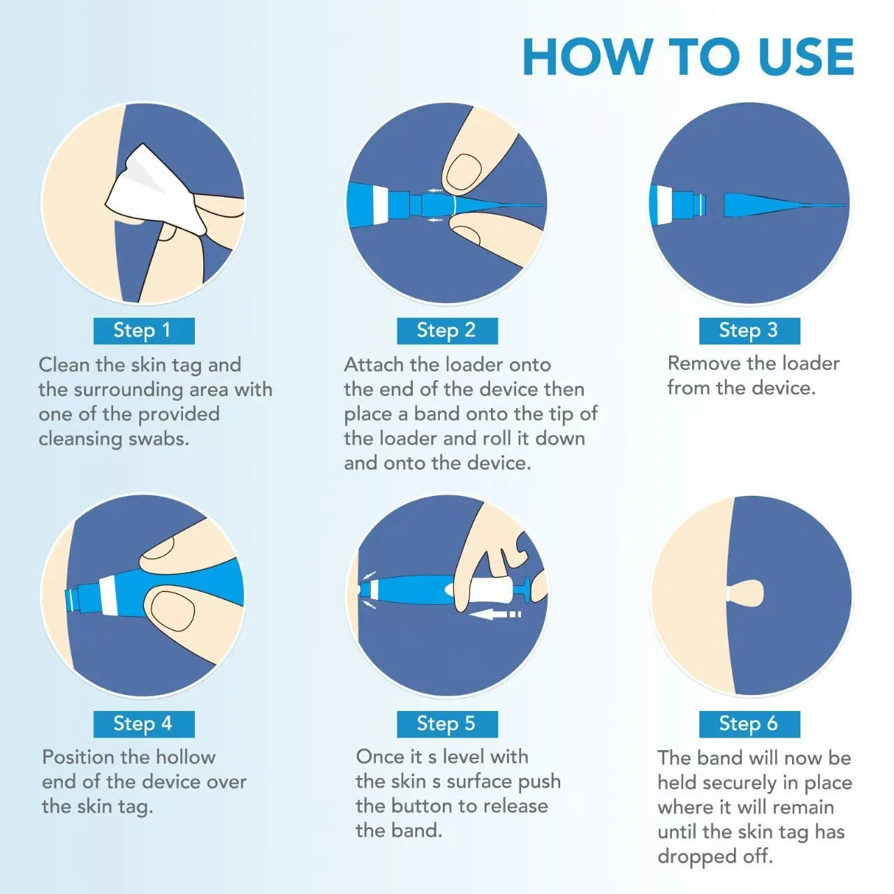 Infographic showing 6 steps to use a painless 2-in-1 skin tag, mole, and wart removal device with blue applicator.