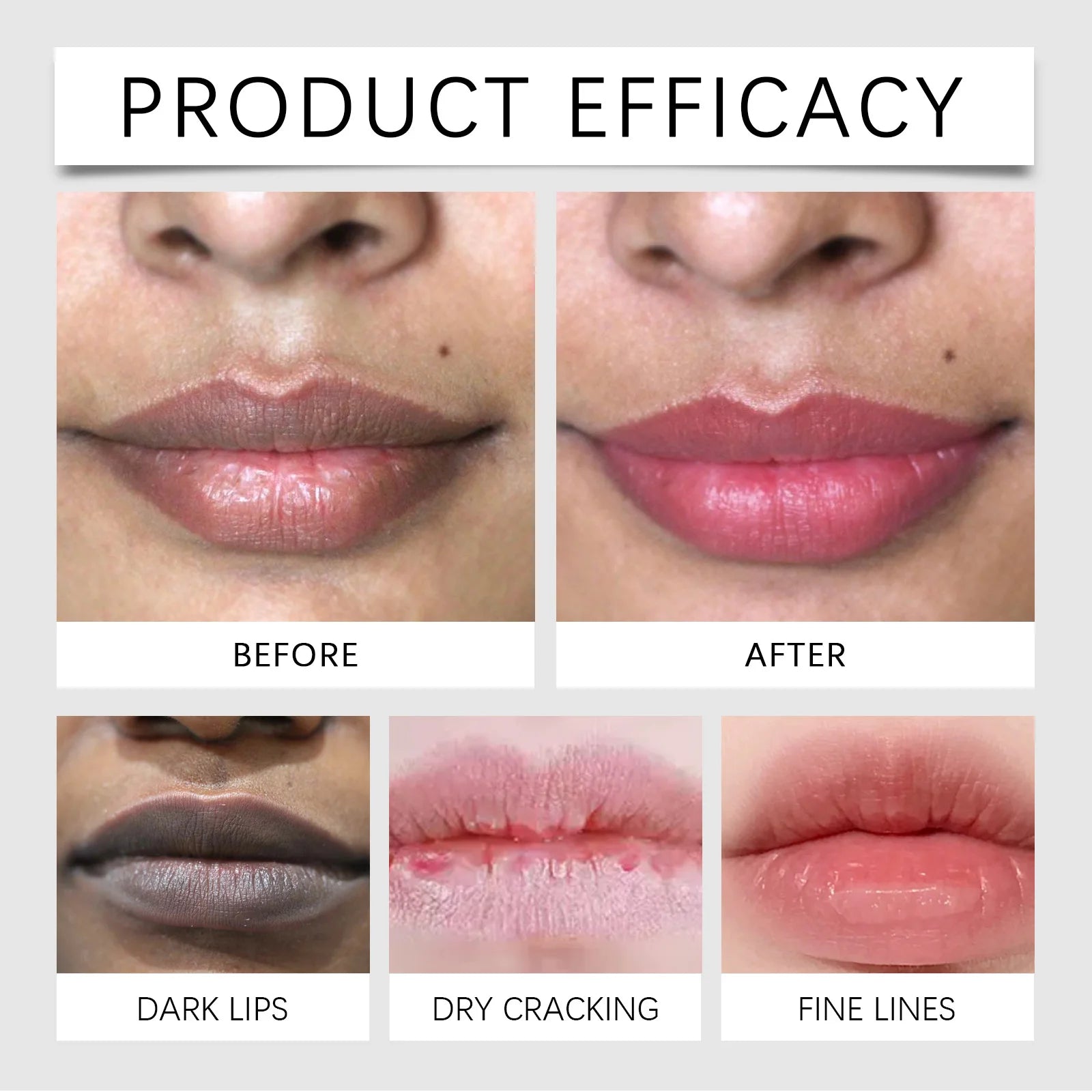 Lip Treatment Balm for Chapped Lips - Deep Hydrating Care by Tidesmit Lip Care Tidesmit