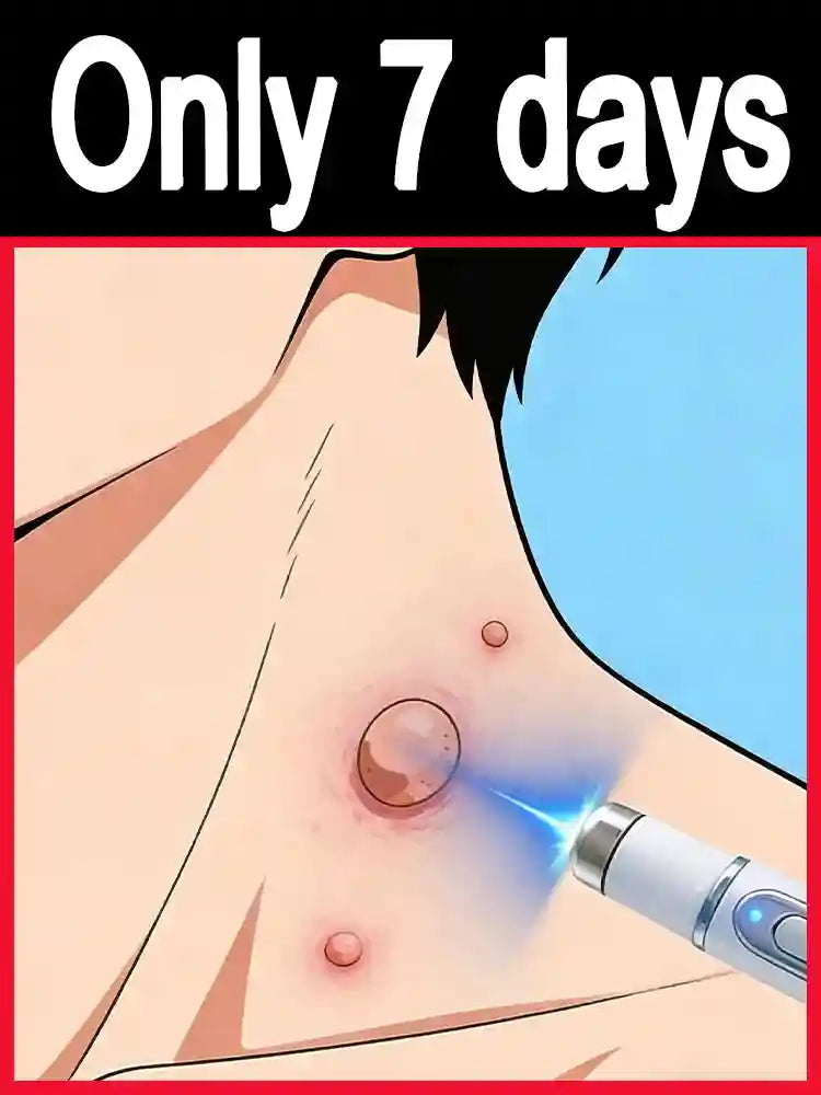 Wart Remover Treatment - Professional Skin Tag Repair Kit (1-2pc) Relaxation Treatment Tidesmit