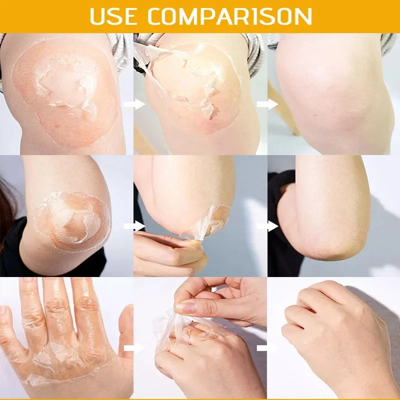 Yellow Peeling Oil for Dark Skin - 100ml Professional Exfoliating Treatment Scrubs Treatments Tidesmit