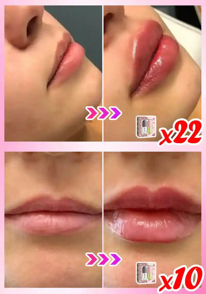 Lip Plumper Serum | Natural Moisturizing Lip Treatment | Tidesmit Lip Care Tidesmit