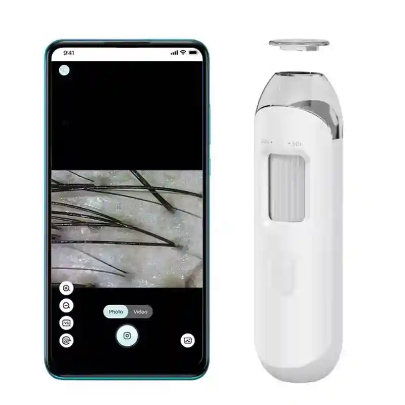 Digital HD scalp dermatoscope and skin analyzer with 50X/200X lens, showing hair diagnostic app interface on smartphone.