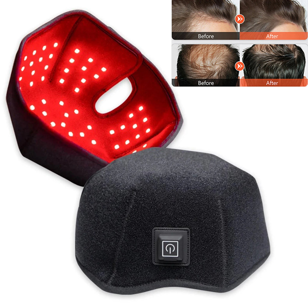 660nm 850nm Red & Infrared Light Hair Growth Cap, USB Charging Red Light Therapy Device Hair Loss Treatment Hair Regrowth Helmet