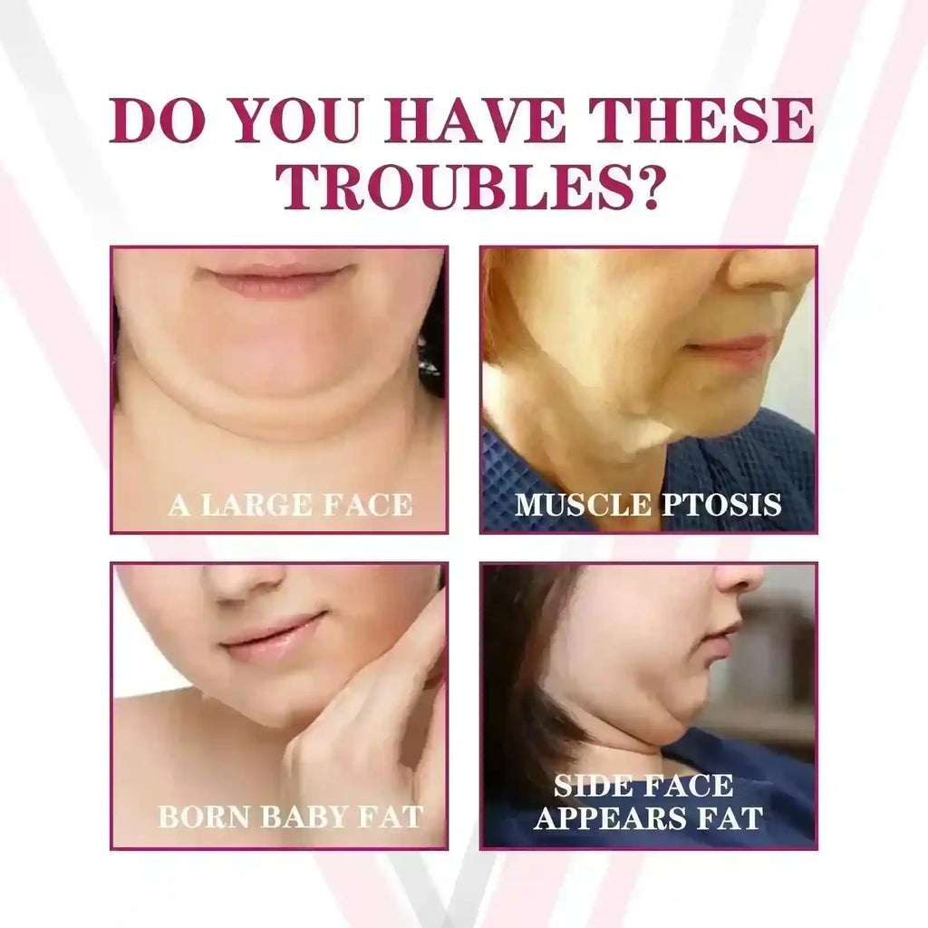 Four-panel comparison showing common face and chin aesthetic concerns like sagging skin and fullness.