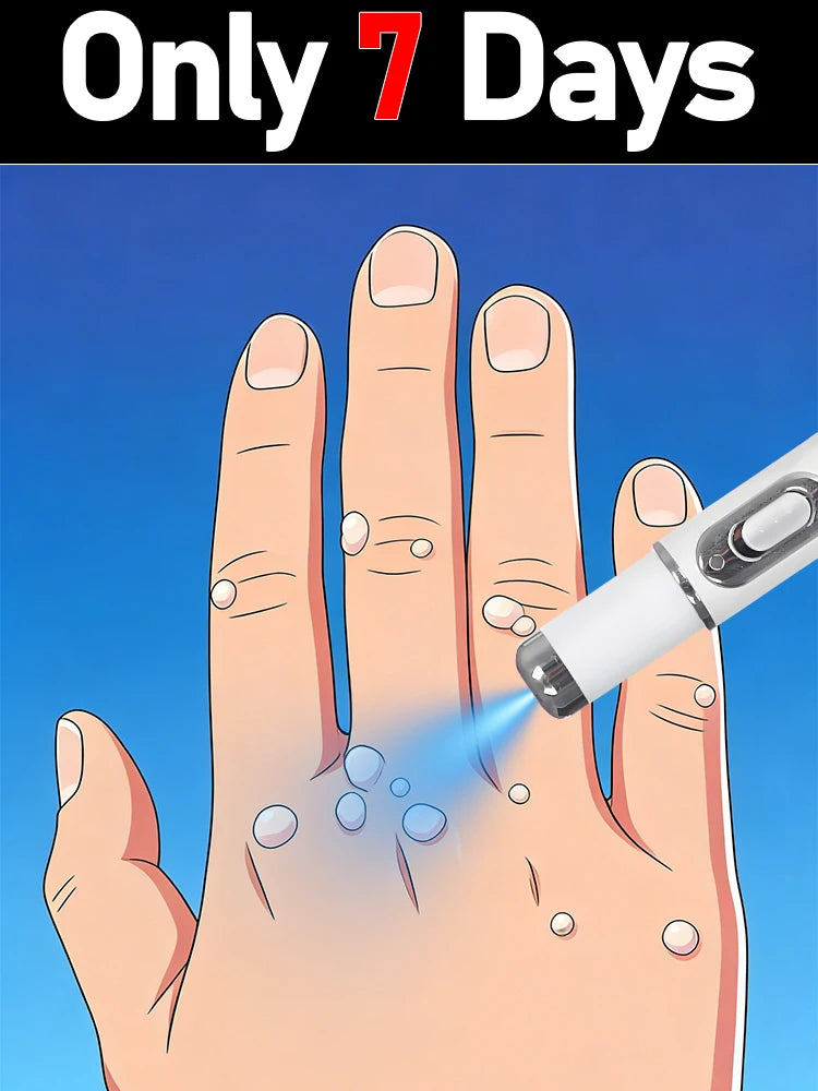 Tidesmit professional wart removal instrument for salon-grade skin tag and flat wart treatment on face and neck